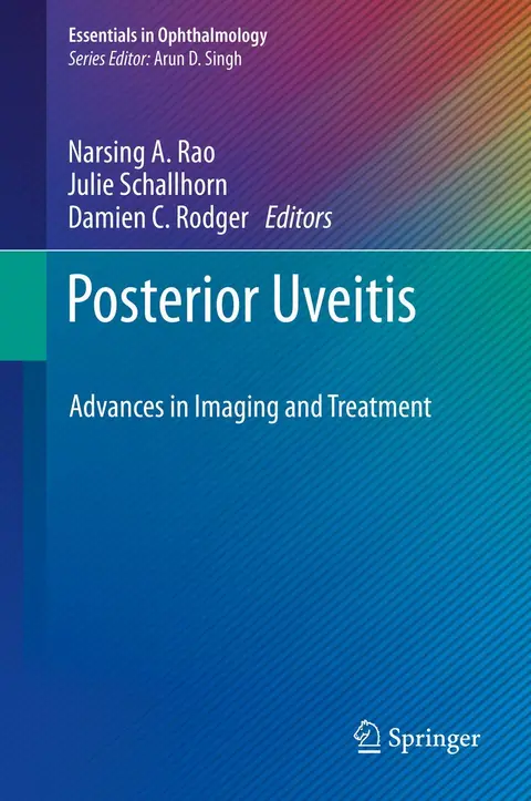 Cover of Posterior Uveitis
