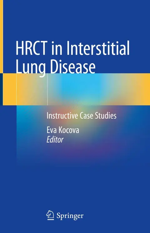 Cover of Hrct in Interstitial Lung Disease