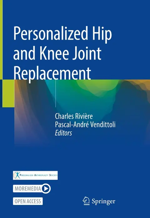 Cover of Personalized Hip and Knee Joint Replacement