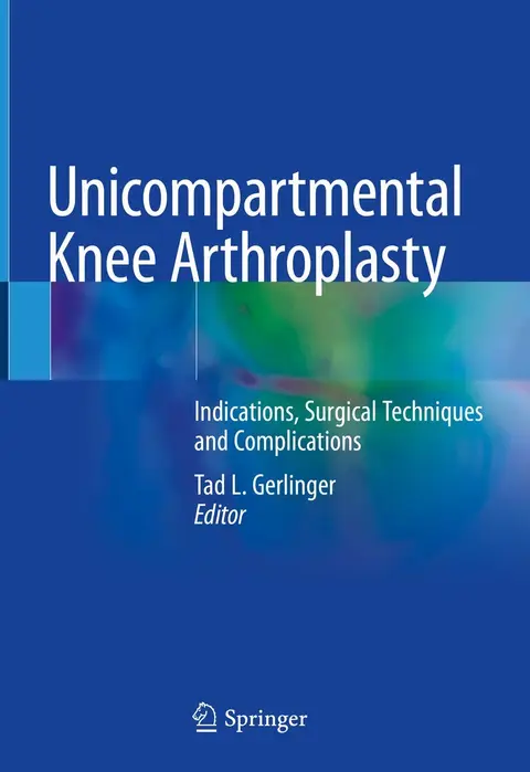 Cover of Unicompartmental Knee Arthroplasty