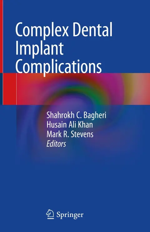 Cover of Complex Dental Implant Complications