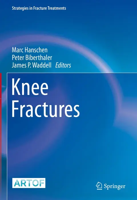 Cover of Knee Fractures