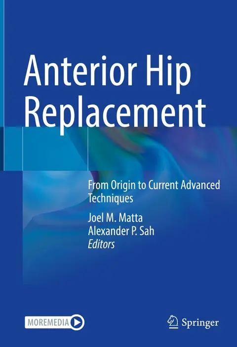 Cover of Anterior Hip Replacement