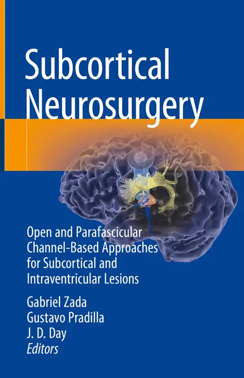 Cover of Subcortical Neurosurgery
