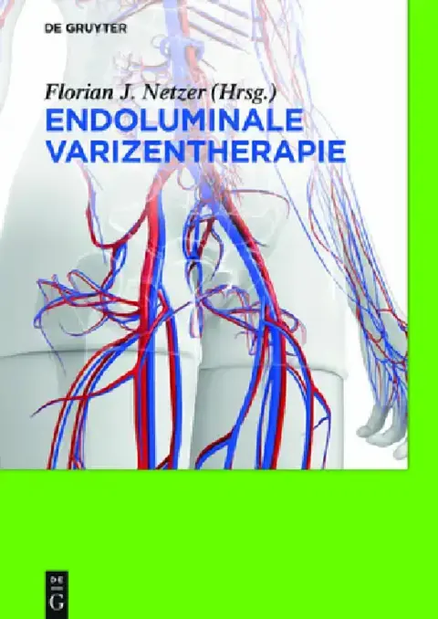 Cover of Endoluminale Varizentherapie