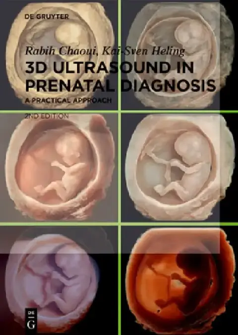 Cover of 3D Ultrasound in Prenatal Diagnosis