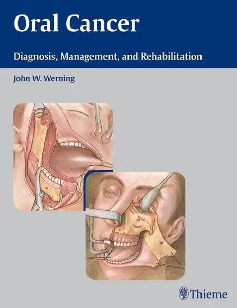 Cover of Oral Cancer