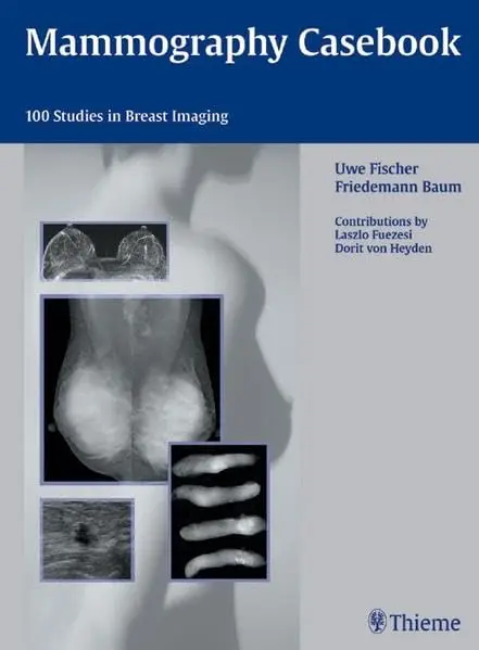 Cover of Mammography Casebook ; 1/E