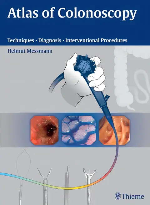 Cover of Atlas of Colonoscopy