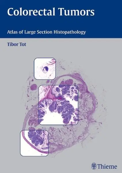 Cover of Colorectal Tumors