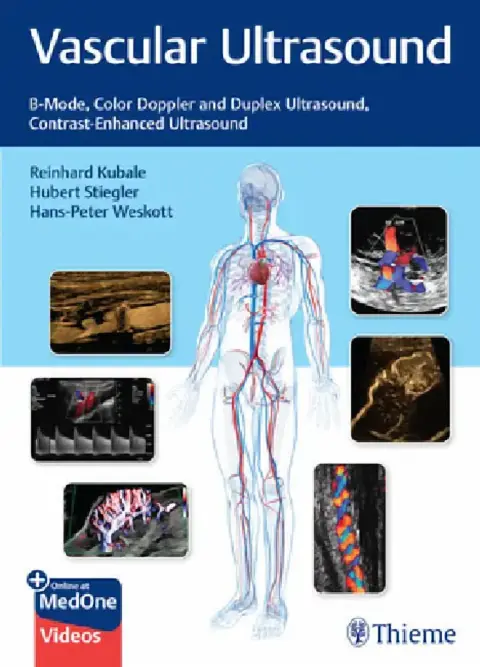 Cover of Vascular Ultrasound