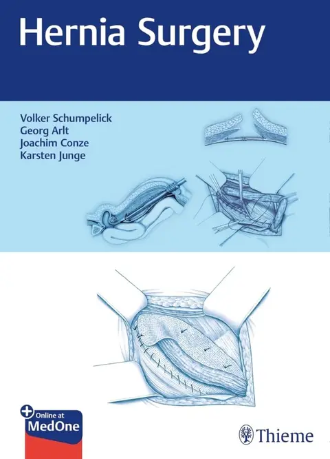 Cover of Hernia Surgery 1st Ed