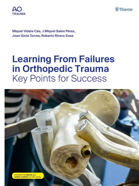 Cover of Learning from Failures in Orthopedic Trauma