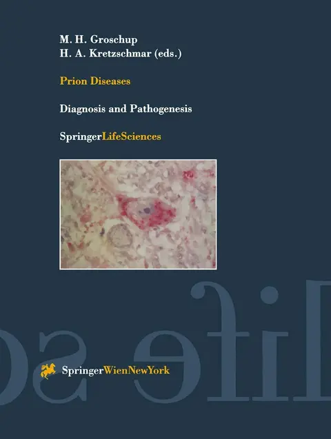 Cover of Prion Diseases