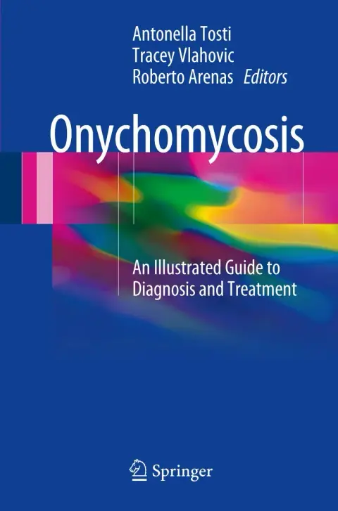 Cover of Onychomycosis