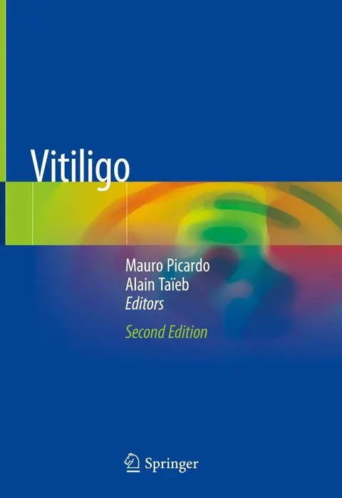 Cover of Vitiligo