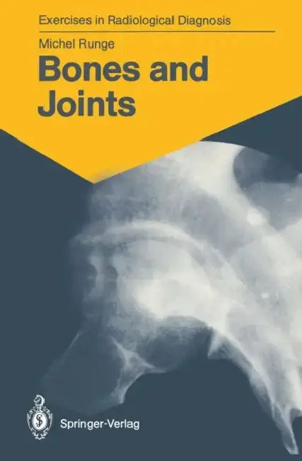 Cover of Bones and Joints