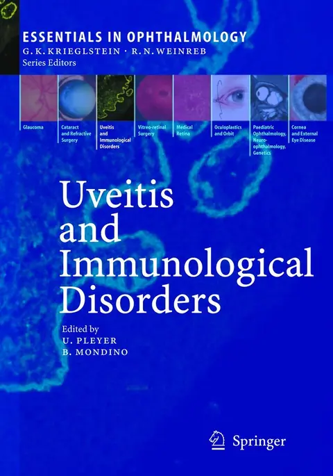 Cover of Uveitis and Immunological Disorders