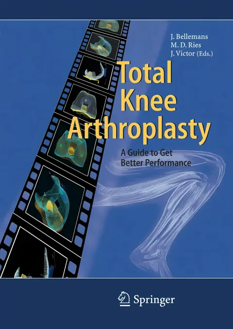 Cover of Total knee arthroplasty