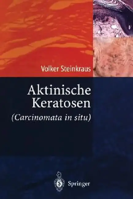Cover of Aktinische Keratosen (Carcinomata in Situ)
