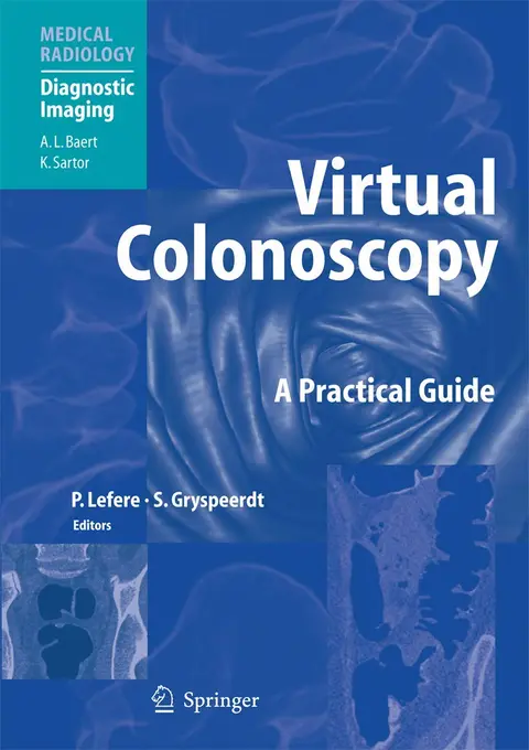 Cover of Virtual Colonoscopy