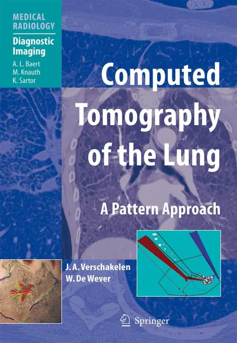 Cover of Computed Tomography of the Lung