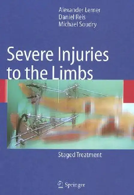 Cover of Severe Injuries to the Limbs