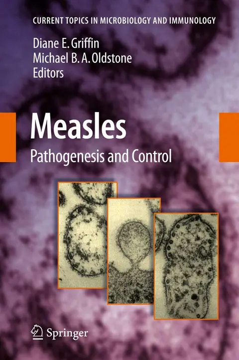 Cover of Measles