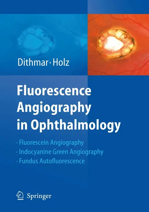 Cover of Fluorescence Angiography in Ophthalmology