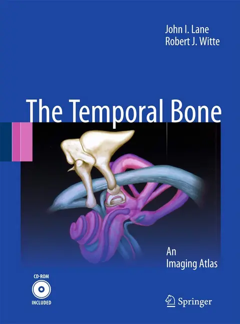 Cover of Temporal Bone