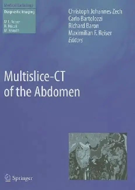 Cover of Multislice-CT of the Abdomen