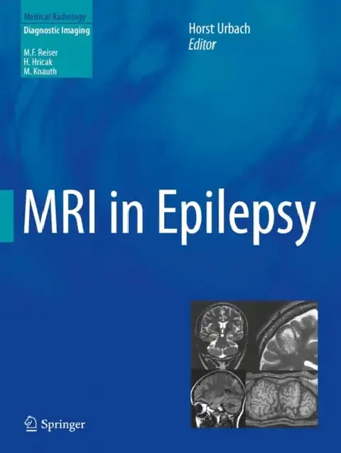 Cover of MRI in Epilepsy