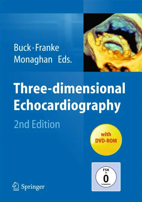 Cover of Three-dimensional Echocardiography