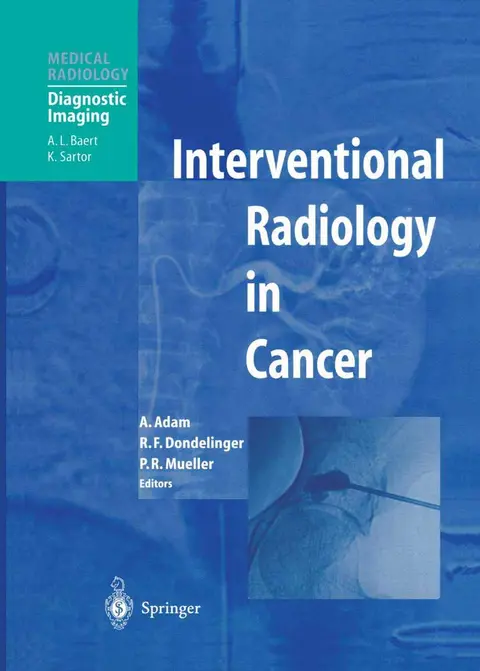 Cover of Interventional Radiology in Cancer