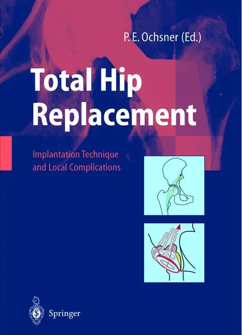 Cover of Total Hip Replacement