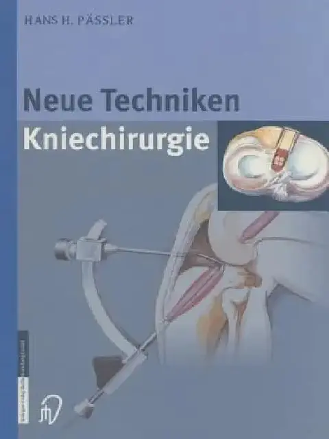 Cover of Neue Techniken Kniechirurgie