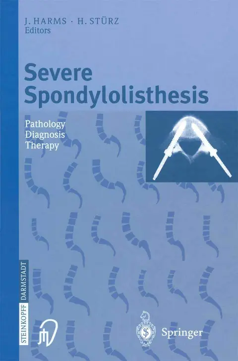 Cover of Severe Spondylolisthesis