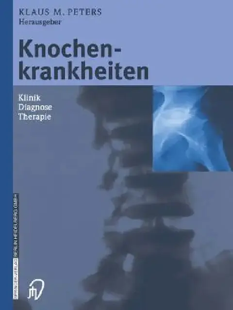 Cover of Knochenkrankheiten