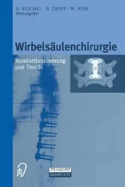 Cover of Wirbelsäulenchirurgie