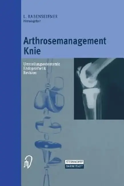 Cover of Arthrosemanagement Knie