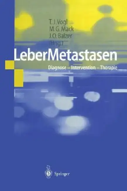 Cover of Lebermetastasen
