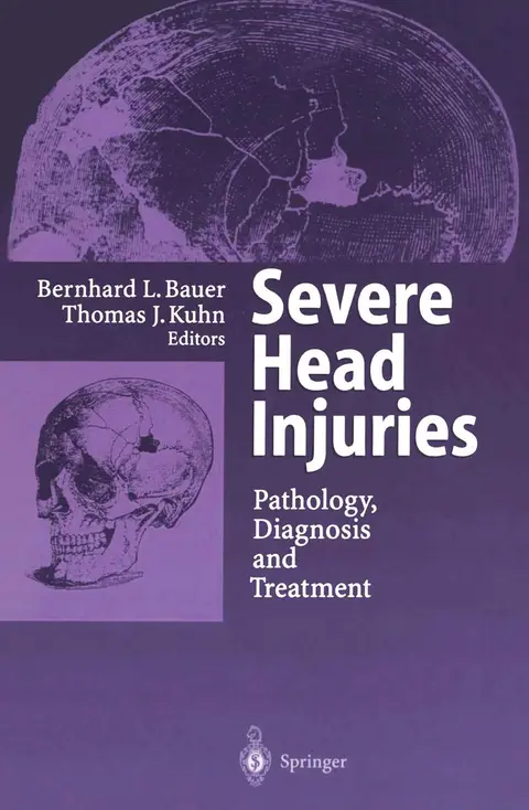 Cover of Severe Head Injuries