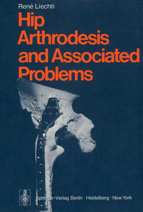 Cover of Hip Arthrodesis and Associated Problems