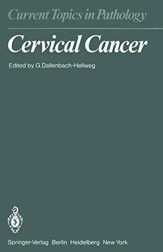 Cover of Cervical Cancer
