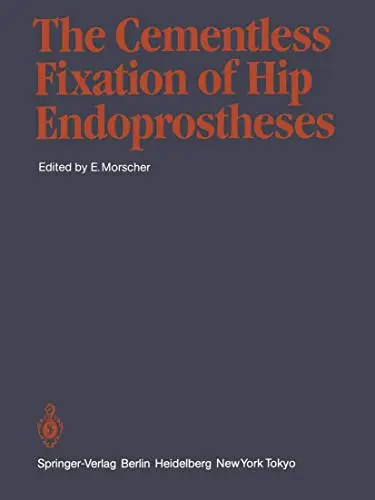 Cover of The Cementless Fixation of Hip Endoprostheses