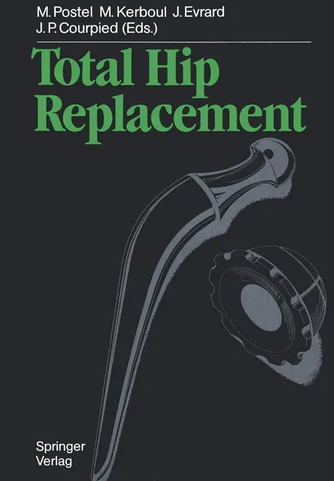 Cover of Total Hip Replacement