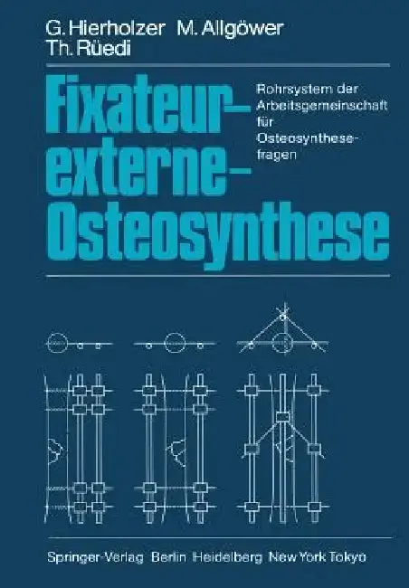 Cover of Fixateur-Externe-Osteosynthese