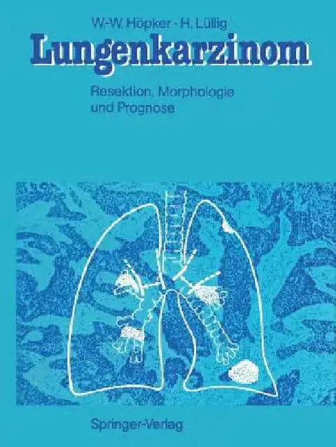 Cover of Lungenkarzinom