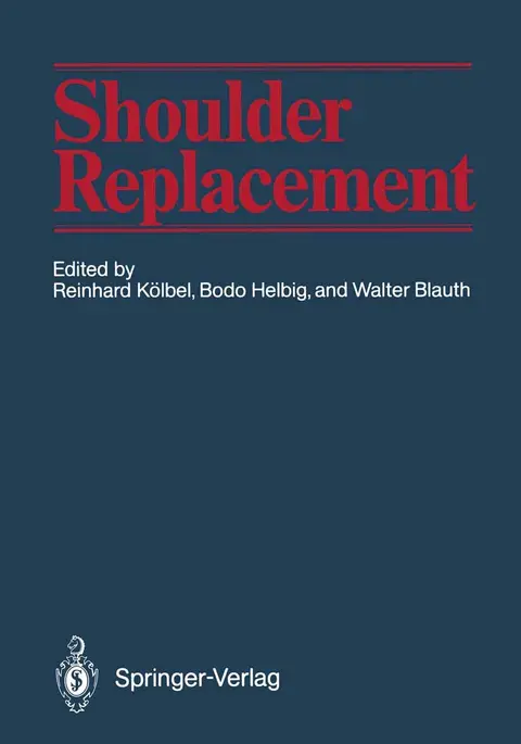 Cover of Shoulder Replacement