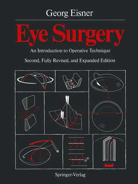 Cover of Eye Surgery